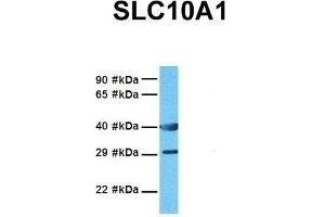 Host:  Rabbit  Target Name:  SLC10A1  Sample Tissue:  Human MDA-MB-435s  Antibody Dilution:  1. (SLC10A1 antibody  (Middle Region))