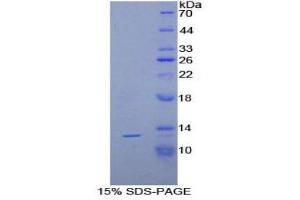 SDS-PAGE (SDS) image for Phospholipase A2-Activating Protein (PLAA) (AA 367-468) protein (His tag) (ABIN1171094)