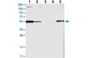 Western blot analysis of Lane 1: RT-4, Lane 2: U-251 MG, Lane 3: Human Plasma, Lane 4: Liver, Lane 5: Tonsil with MFSD11 polyclonal antibody  at 1:250-1:500 dilution. (MFSD11 antibody)