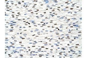 NXF3 antibody was used for immunohistochemistry at a concentration of 4-8 ug/ml to stain Myocardial cells (arrows) in Human Heart. (NXF3 antibody  (C-Term))