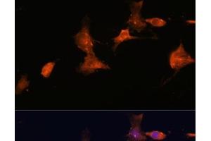 Immunofluorescence analysis of C6 cells using TSC2 Polyclonal Antibody at dilution of 1:100. (Tuberin antibody)