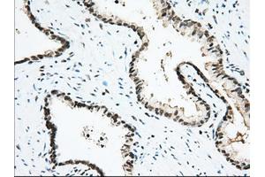 Immunohistochemical staining of paraffin-embedded Human Kidney tissue using anti-USP5 mouse monoclonal antibody. (USP5 antibody)