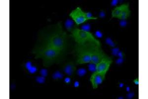 Image no. 7 for anti-Proteasome (Prosome, Macropain) 26S Subunit, ATPase, 3 (PSMC3) antibody (ABIN1501331) (PSMC3 antibody)