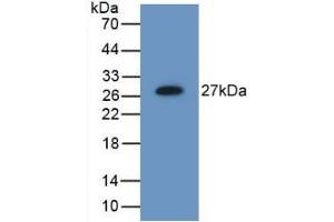 Detection of Recombinant MB21D1, Mouse using Polyclonal Antibody to Mab21 Domain Containing Protein 1 (MB21D1) (C6orf150 antibody  (AA 211-395))