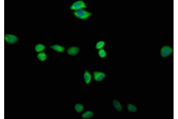 TTC14 antibody  (AA 569-770)