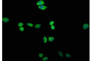 Immunofluorescence staining of Hela cells with ABIN7171907 at 1:200, counter-stained with DAPI. (TTC14 antibody  (AA 569-770))