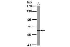 Image no. 2 for anti-Nicotinic Acetylcholine Receptor beta (CHRNB1) (AA 274-501) antibody (ABIN1497506)