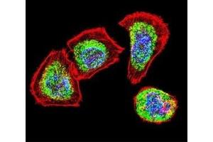Confocal immunofluorescent analysis of Vimentin antibody with U251 cells followed by Alexa Fluor 488-conjugated goat anti-rabbit lgG (green). (Vimentin antibody)