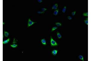 ZDHHC2 antibody  (AA 230-367)