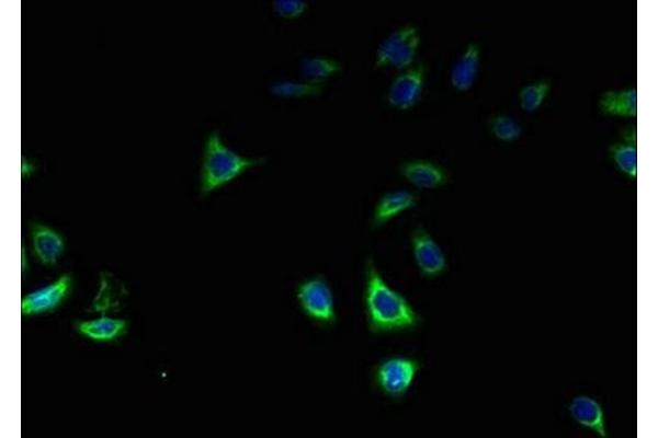 ZDHHC2 antibody  (AA 230-367)