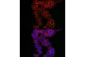 Immunofluorescence analysis of THP-1 cells using CD38 Rabbit pAb (ABIN3015544, ABIN3015545, ABIN1679089 and ABIN6218776) at dilution of 1:100 (40x lens). (CD38 antibody  (AA 1-300))