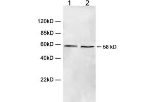 Western blot analysis of cell lysate using 1 µg/mL Rabbit Anti-Chk1 (Ser280) Polyclonal Antibody (ABIN398709) Lane 1: Hela cell lysateLane 2: HEK293 cell lysateThe signal was developed with IRDyeTM 800 Conjugated Goat Anti-Rabbit IgG. (CHEK1 antibody  (Ser280))