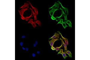 ABIN6265129 and ABIN6273163 staining Hela cells by IF/ICC.