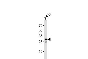 Western blot analysis of lysate from A431 cell line, using RN Antibody (Center) (ABIN651929 and ABIN2840458). (RNF208 antibody  (AA 86-115))