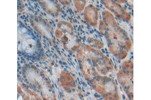 Used in DAB staining on fromalin fixed paraffin- embedded Kidney tissue (TBCA antibody  (AA 2-108))