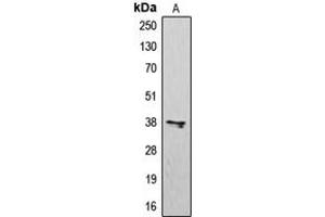 Western blot analysis of CD183 expression in K562 (A) whole cell lysates. (CXCR3 antibody  (Center))