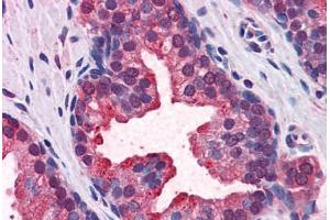 Human Prostate: Formalin-Fixed, Paraffin-Embedded (FFPE) (KEAP1 antibody  (AA 21-70))