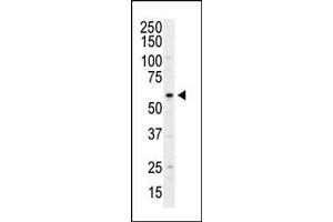 Image no. 1 for anti-Phosphatidylinositol 4-Kinase Type 2 alpha (PI4K2A) (N-Term) antibody (ABIN360472)