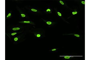 Immunofluorescence of purified MaxPab antibody to SSB on HeLa cell. (SSB antibody  (AA 1-408))