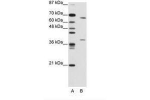 Image no. 2 for anti-Grainyhead-Like 3 (GRHL3) (AA 529-578) antibody (ABIN203223) (GRHL3 antibody  (AA 529-578))