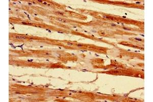 Immunohistochemistry of paraffin-embedded human heart tissue using ABIN7142451 at dilution of 1:100 (MRPL55 antibody  (AA 34-128))