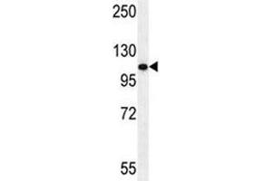 Androgen Receptor antibody western blot analysis in HeLa lysate (Androgen Receptor antibody  (AA 365-392))