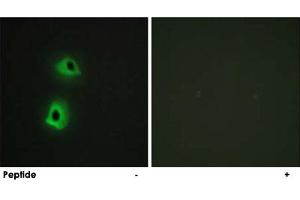 Immunofluorescence analysis of HeLa cells, using TRAF3IP3 polyclonal antibody .