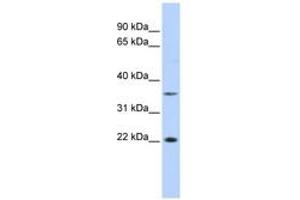 Image no. 1 for anti-Chromosome 16 Open Reading Frame 80 (C16orf80) (C-Term) antibody (ABIN6742820) (C16orf80 antibody  (C-Term))