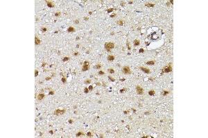 Immunohistochemistry of paraffin-embedded rat brain using UBQLN4 Rabbit pAb (ABIN7271124) at dilution of 1:150 (40x lens). (UBQLN4 antibody  (AA 300-390))