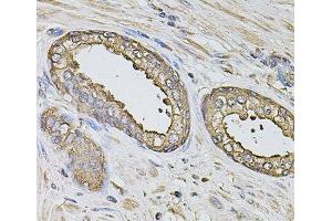 Immunohistochemistry of paraffin-embedded Human prostate using S100A12 Polyclonal Antibody at dilution of 1:100 (40x lens). (S100A12 antibody)