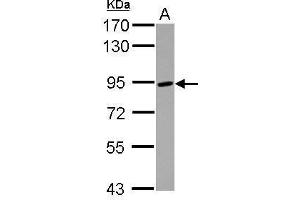 WB Image Sample (30 ug of whole cell lysate) A: Raji 7. (ADAM8 antibody  (C-Term))