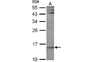 WB Image Sample (30 ug of whole cell lysate) A: NIH-3T3 12% SDS PAGE antibody diluted at 1:1000 (UBE2B antibody)