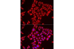 Immunofluorescence analysis of HeLa cell using ST3GAL3 antibody. (ST3GAL3 antibody)