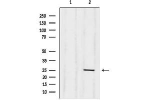 Western blot analysis of lysates from HepG2, using C Antibody.