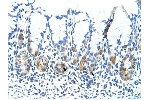 ADAT1 antibody was used for immunohistochemistry at a concentration of 4-8 ug/ml to stain Epithelial cells of fundic gland (arrows) in Human Stomach. (ADAT1 antibody  (C-Term))