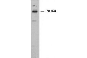 Western blot analysis using PAD1 antibody Cat.