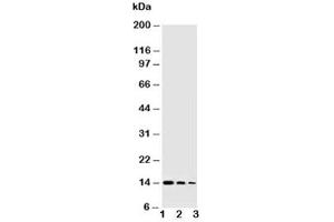 Western blot testing of NGF antibody and Lane 1:  Recombinant human protein 10ng (Nerve Growth Factor antibody  (AA 122-241))