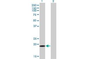 Western Blot analysis of YSK4 expression in transfected 293T cell line by YSK4 MaxPab polyclonal antibody.
