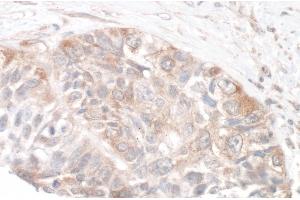 Immunohistochemistry (IHC) image for anti-RPTOR Independent Companion of mTOR, Complex 2 (RICTOR) (C-Term) antibody (ABIN7454633) (RICTOR antibody  (C-Term))