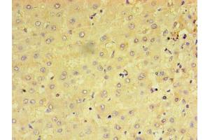 Immunohistochemistry of paraffin-embedded human liver tissue using ABIN7159237 at dilution of 1:100 (PRAME antibody  (AA 1-509))