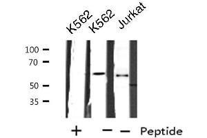 Western blot analysis of extracts from K562/Jurkat cells, using CYP2A7 antibody. (CYP2A7 antibody)