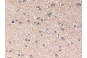 Detection of ADRM1 in Human Cerebrum Tissue using Polyclonal Antibody to Adhesion Regulating Molecule 1 (ADRM1) (ADRM1 antibody  (AA 2-407))