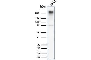 Western Blot Analysis of Human K562 cell lysate using Spectrin alpha 1 Rabbit Recombinant Monoclonal Antibody (SPTA1/2939R).