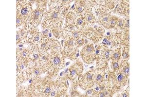 ST3GAL3 antibody