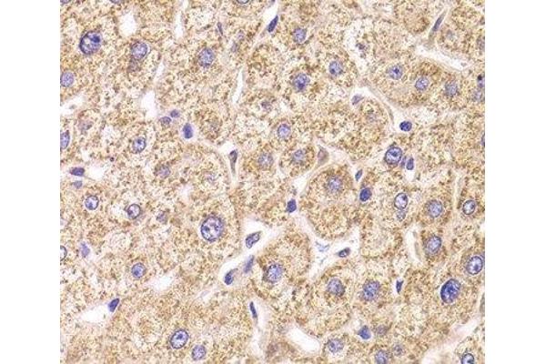 ST3GAL3 antibody