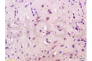 Formalin-fixed and paraffin embedded rat brain labeled with Anti-CD200R/Orexin receptor Polyclonal Antibody, Unconjugated (ABIN737586) at 1:200 followed by conjugation to the secondary antibody and DAB staining. (OX1R/OX2R antibody  (AA 321-425))