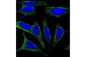 Fluorescent image of SH-SY5Y cells stained with CHRM2 Antibody (ABIN6242476 and ABIN6577085). (Muscarinic Acetylcholine Receptor M2 antibody)