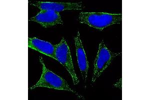 Fluorescent image of SH-SY5Y cells stained with CHRM2 Antibody (ABIN6242476 and ABIN6577085).