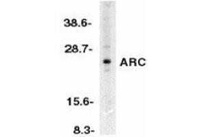 Western blot analysis of ARC in HeLa whole cell lysates with AP30077PU-N ARC antibody at 1/500 dilution.