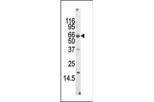 The anti-MLLT3 Pab (ABIN390129 and ABIN2840634) is used in Western blot to detect MLLT3 in mouse cerebellum tissue lysate (AF9 antibody  (AA 407-438))